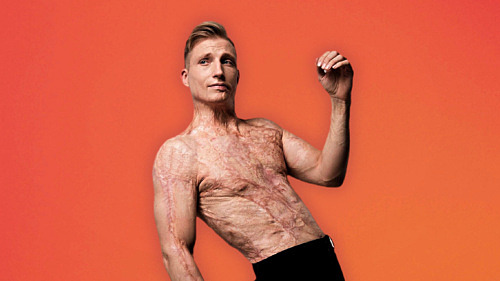 Axel Schylström – Den brända idolen